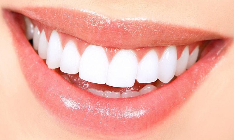 خدمات دندانپزشکی زیبایی و ترمیمی زیر نظر پزشک فوق متخصص